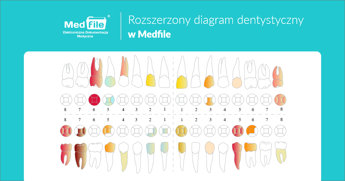 Rozszerzony diagram dentystyczny