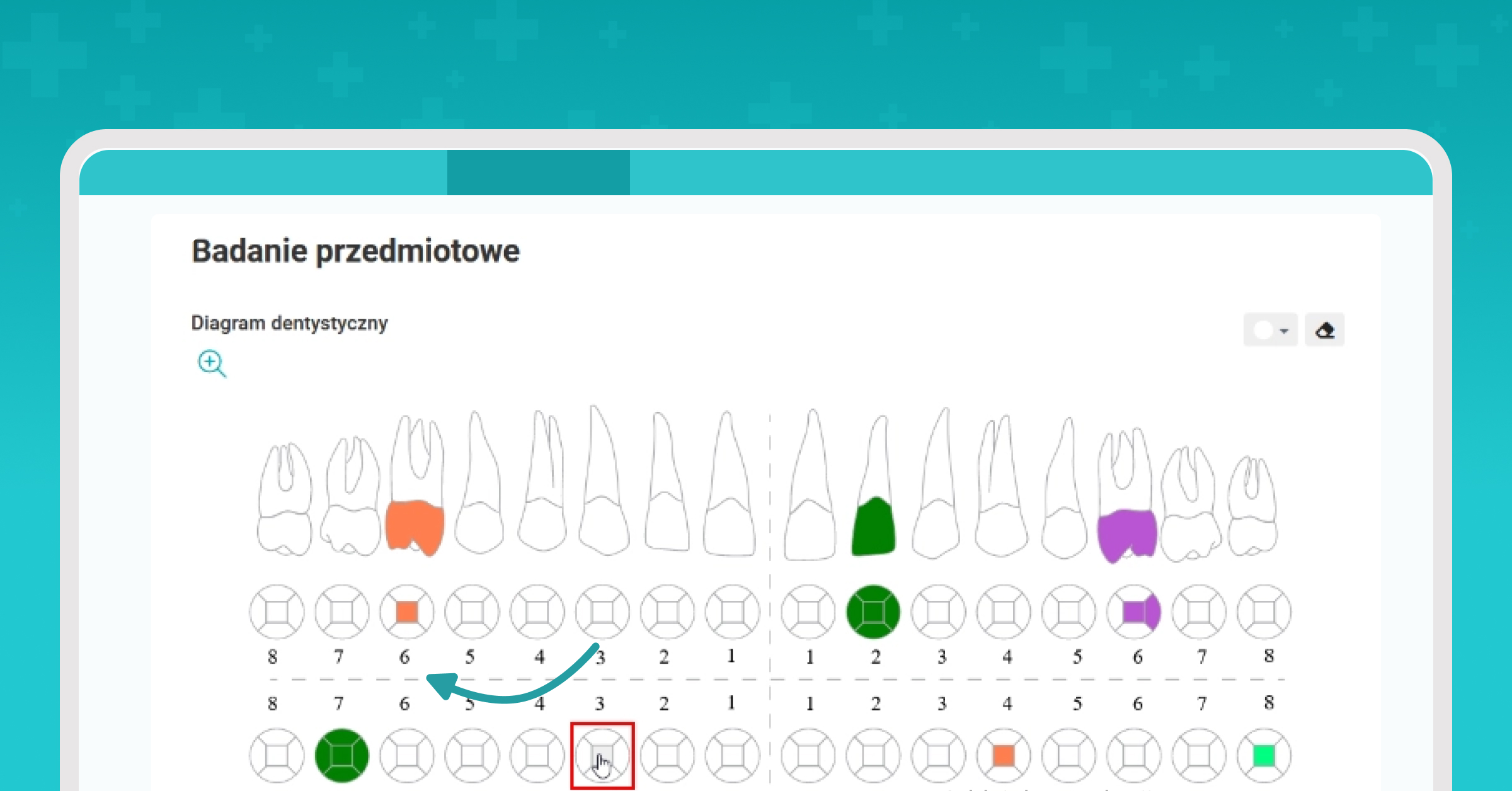 Diagram dentystyczny rozszerzony