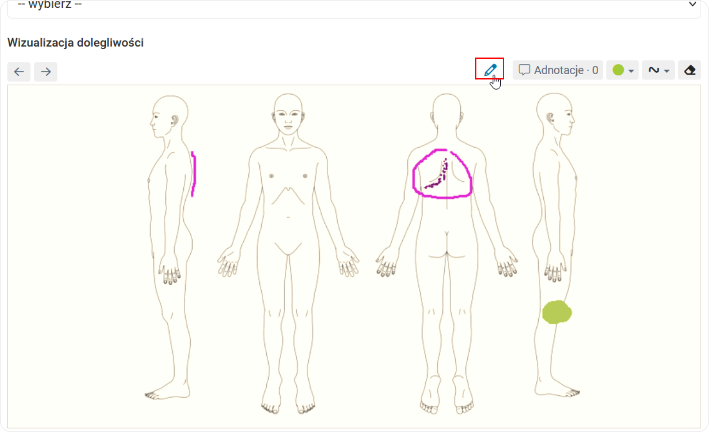 Dodaj adnotację do dolegliwości 