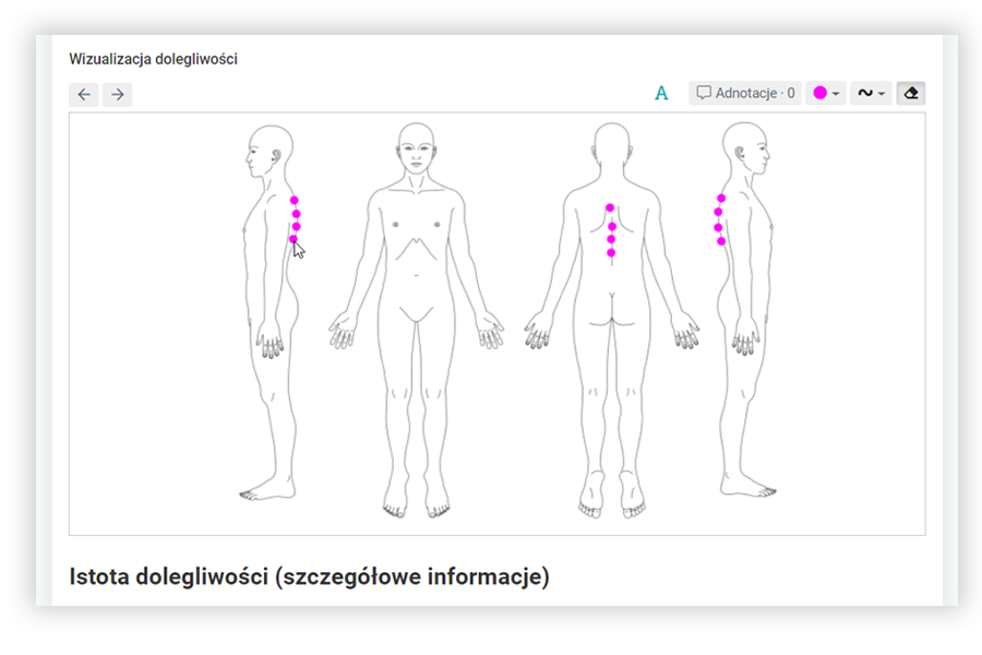 Oznacz obszar bólowy