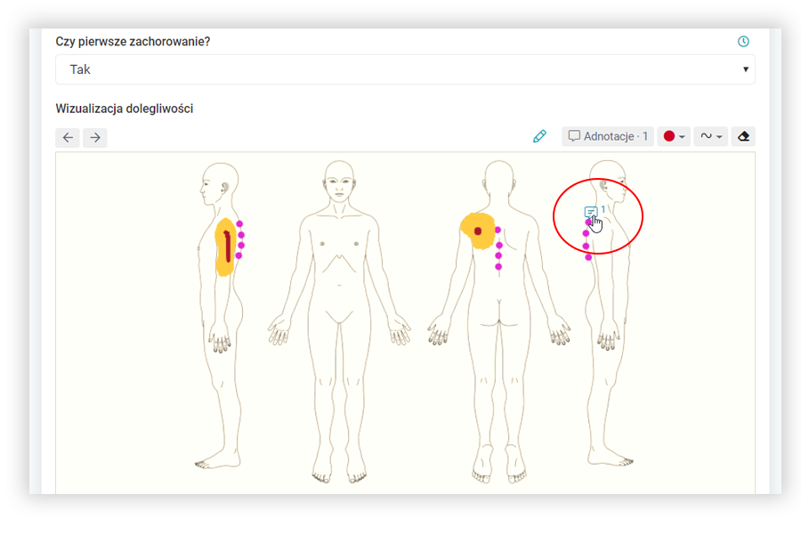 Przeciągnij i upuść adnotację