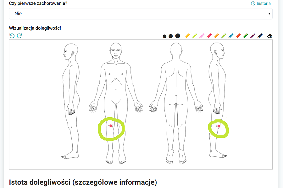 Widok wizualizacji dolegliwości danego pacjenta